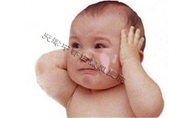 婴儿脸上出现白斑是怎么回事？