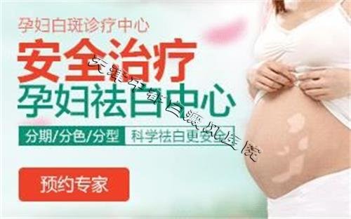 孕妇白癜风的安全治疗